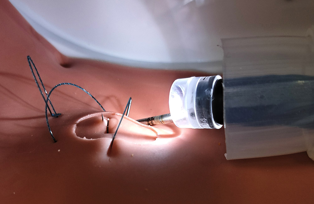 Phantom aus Silikon Phantom aus Silikon